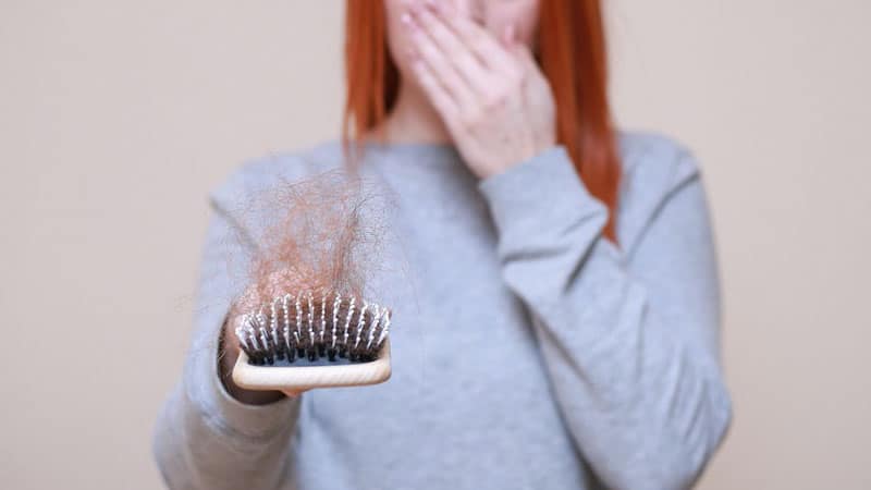 Haravfall 5 tecken som avslöjar om du lider av håravfall